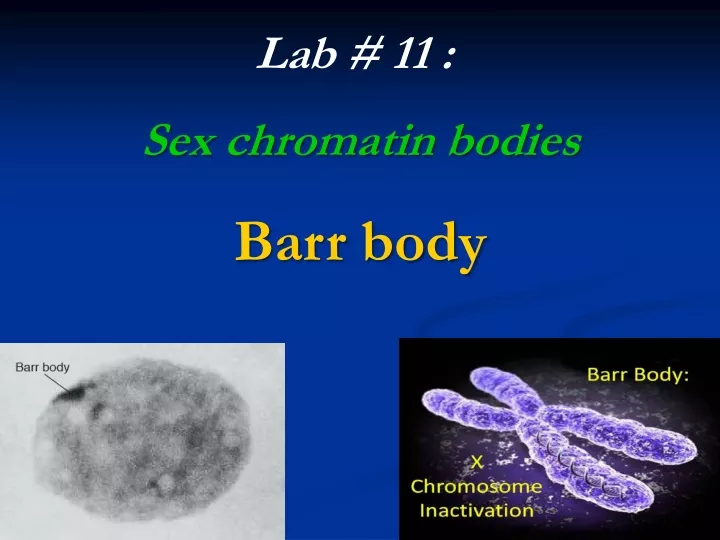 lab 11 sex chromatin bodies barr body