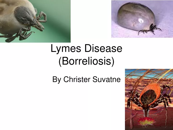 lymes disease borreliosis