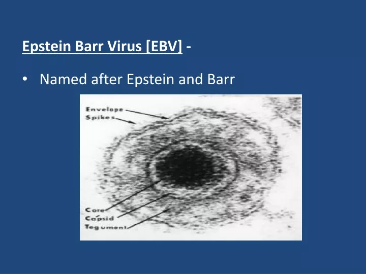 epstein barr virus ebv named after epstein