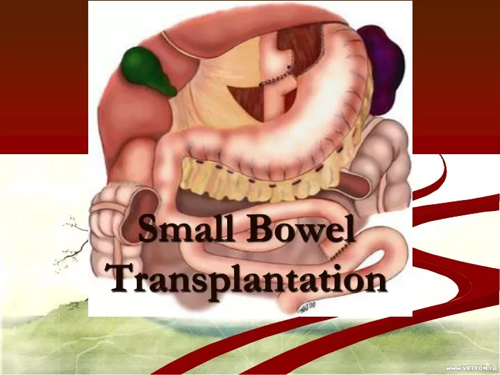 small bowel transplantation
