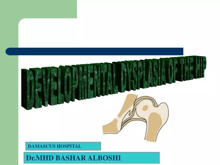 developmental dysplasia of the hip