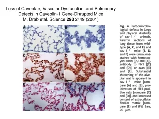 Loss of Caveolae, Vascular Dysfunction, and Pulmonary Defects in Caveolin-1 Gene-Disrupted Mice