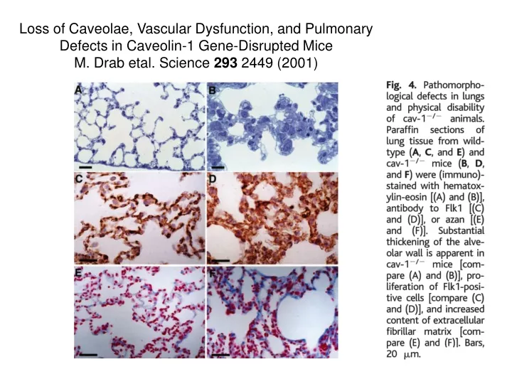 loss of caveolae vascular dysfunction