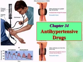 Chapter 34 Antihypertensive Drugs