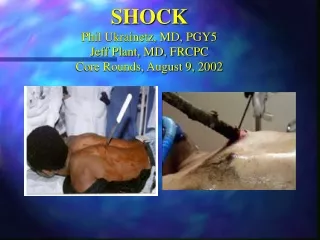 SHOCK Phil Ukrainetz, MD, PGY5 Jeff Plant, MD, FRCPC Core Rounds, August 9, 2002