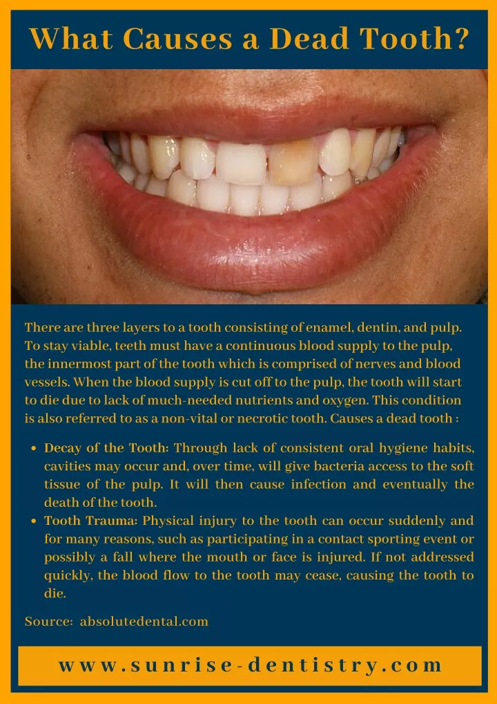 what causes a dead tooth