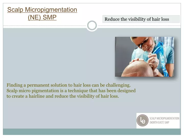 scalp micropigmentation ne smp