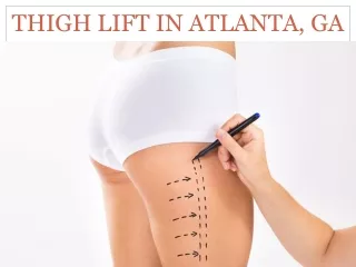 Thigh Lift Atlanta, GA | Buckhead Thigh Lift