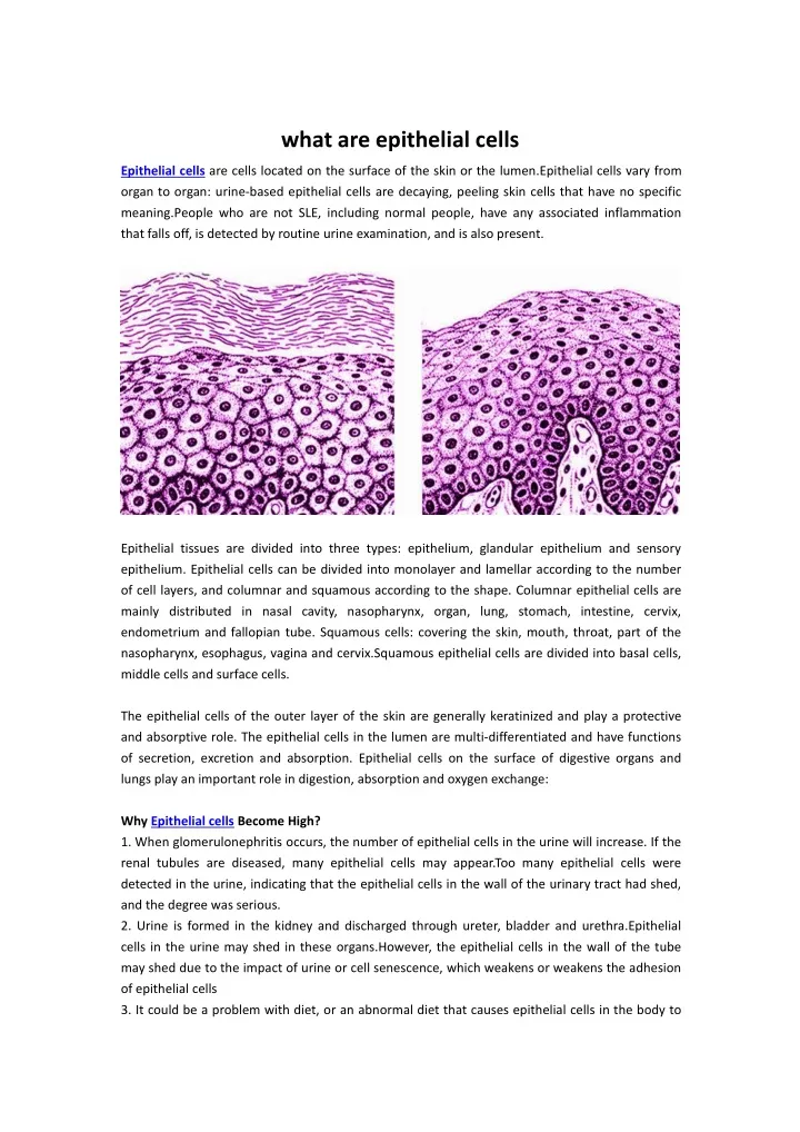 what are epithelial cells