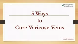 5 Ways to Cure Varicose Veins | Healing Hands Clinic