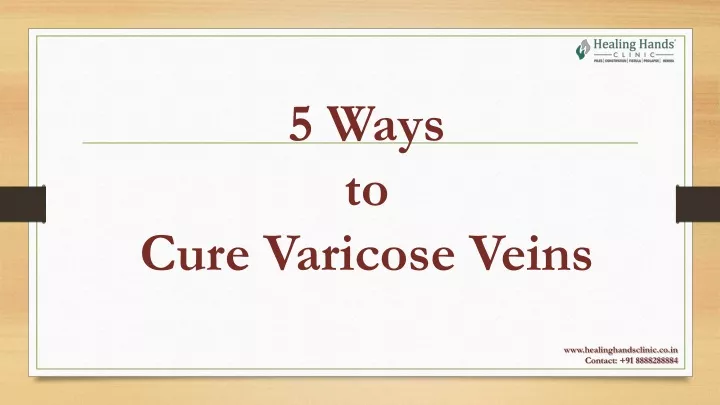 5 ways to cure varicose veins