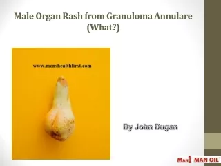 Male Organ Rash from Granuloma Annulare (What?)