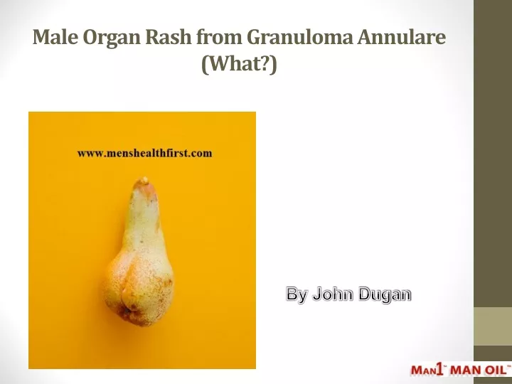 male organ rash from granuloma annulare what