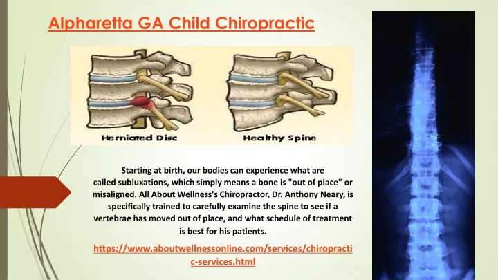 alpharetta ga child chiropractic