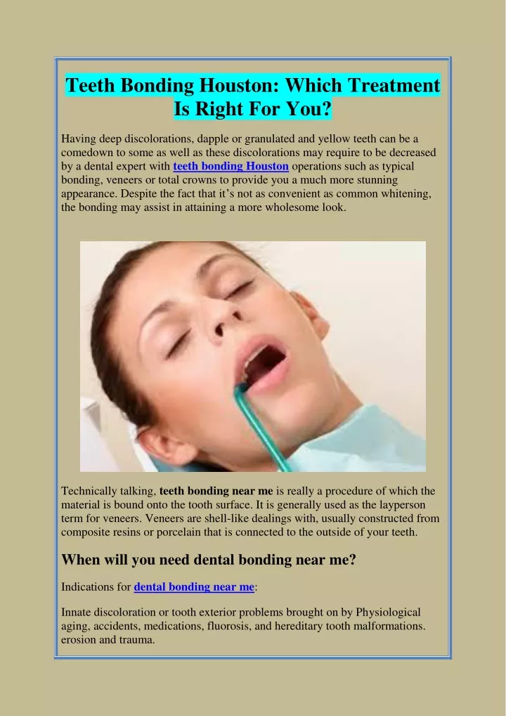 teeth bonding houston which treatment is right