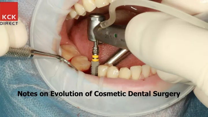 notes on evolution of cosmetic dental surgery