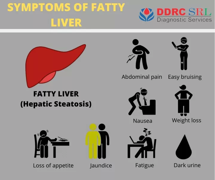 symptoms of fatty liver