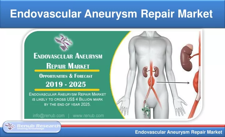 endovascular aneurysm repair market