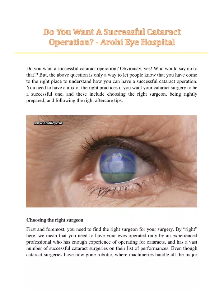 do you want a successful cataract operation