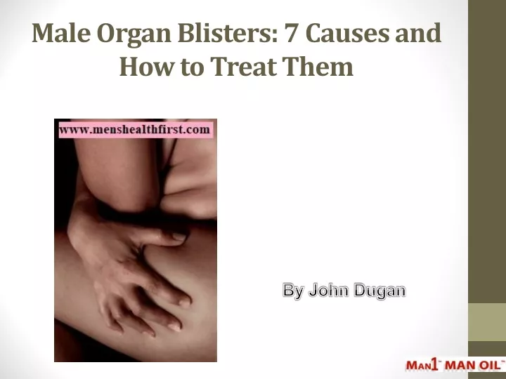 male organ blisters 7 causes and how to treat them