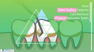 How Simi Valley Patients Can Remove Plaque between Teeth