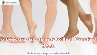 6 Effective Treatments to Heal Cracked Heels