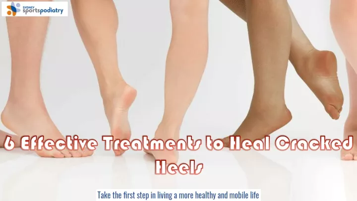 6 effective treatments to heal cracked heels