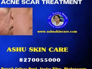 best skin care clinic in bhubanswar odisa