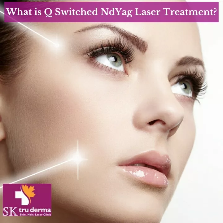 what is q switched ndyag laser treatment