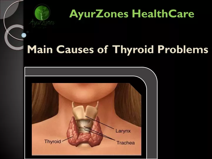 main causes of thyroid problems