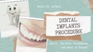 Dental implants: What to Expect