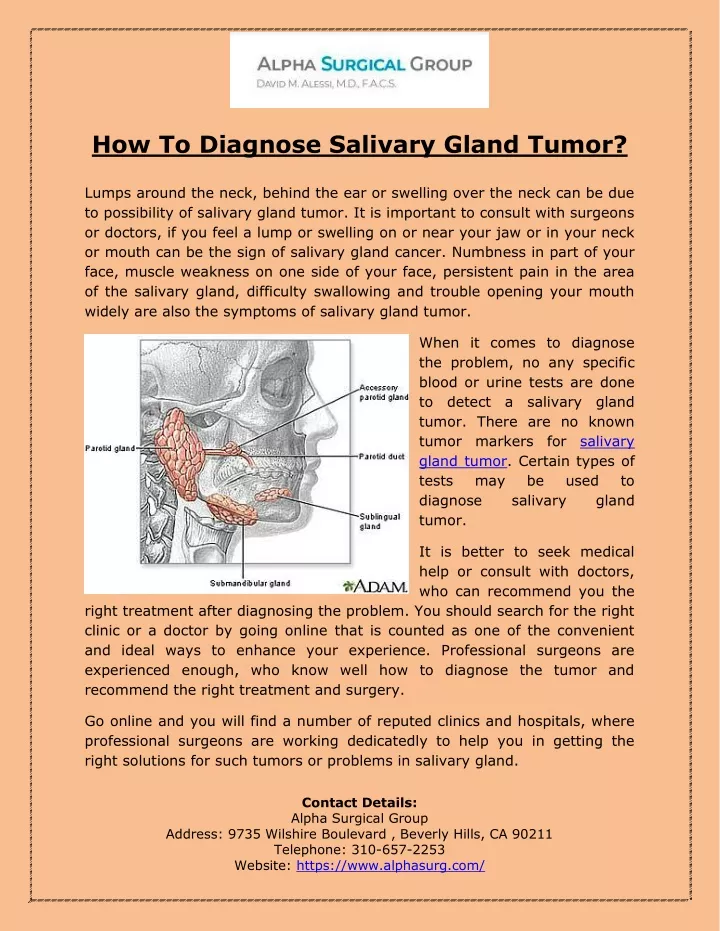 how to diagnose salivary gland tumor