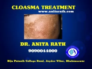 best cloasma treatment clinic in bhubaneswar odisha