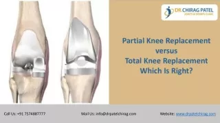 Partial Knee Replacement versus Total Knee Replacement: Which Is Right? | Dr Chirag Patel