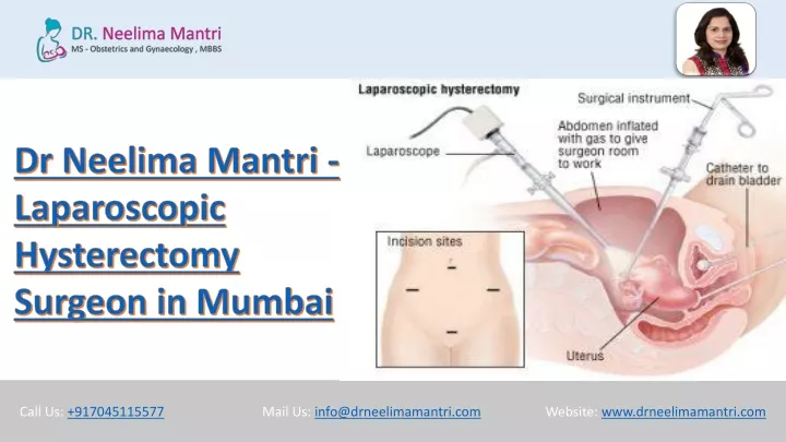 dr neelima mantri laparoscopic hysterectomy