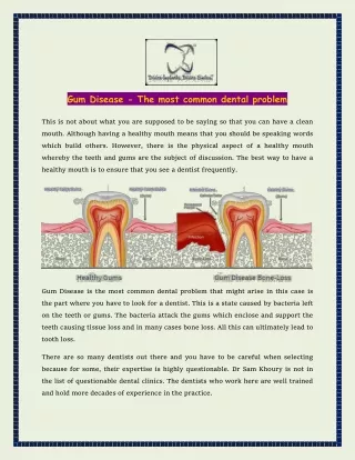 Gum Disease - The most common dental problem