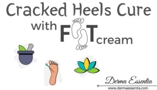Cracked Heels Cure with Foot Crack Cream, Why?
