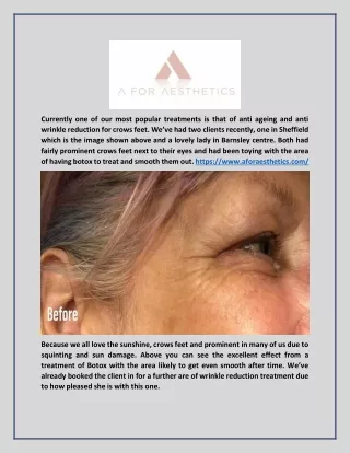 Anti-Wrinkle Treatments in South Yorkshire | Aforaesthetics.com