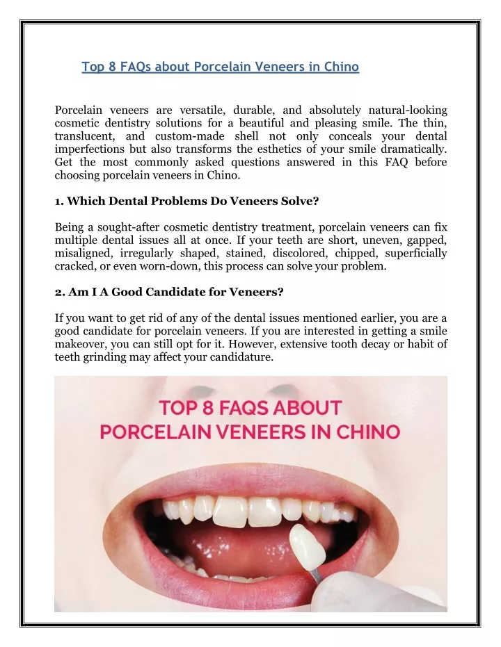 top 8 faqs about porcelain veneers in chino