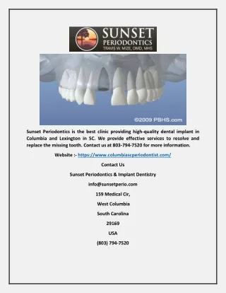 Dental Implant in Columbia - columbiascperiodontist.com