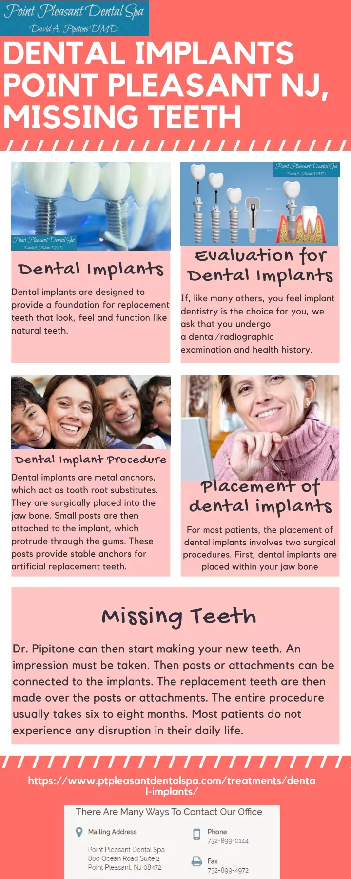 dental implants point pleasant nj missing teeth