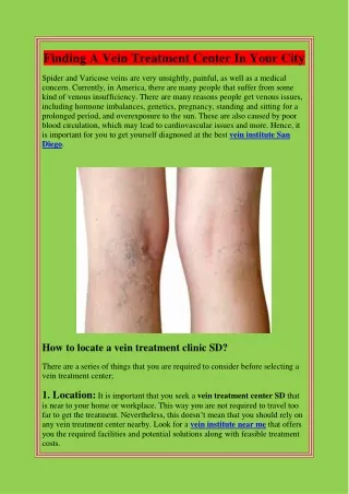 Finding A Vein Treatment Center In Your City