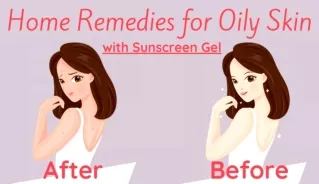 Home Remedies for Oily Skin with Best Sunscreen Gel