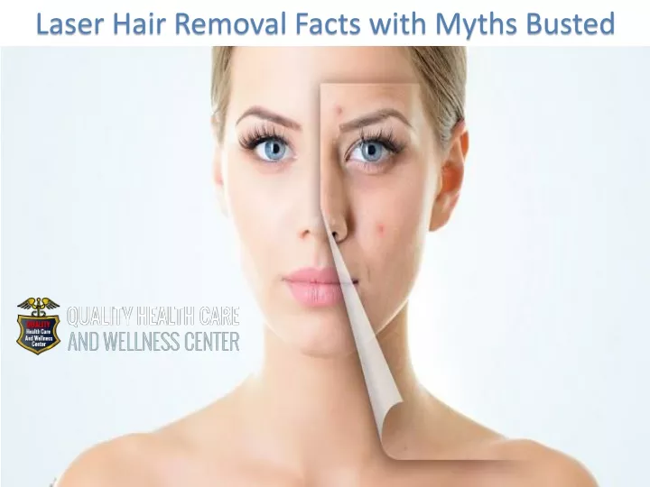 laser hair removal facts with myths busted
