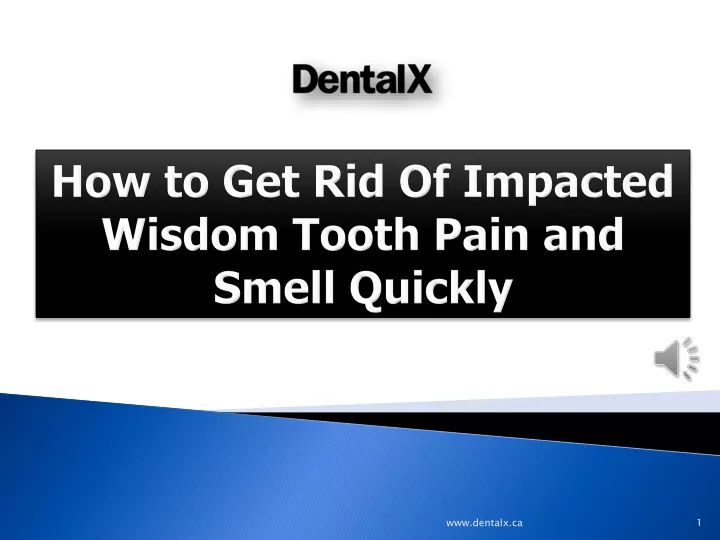 how to get rid of impacted wisdom tooth pain