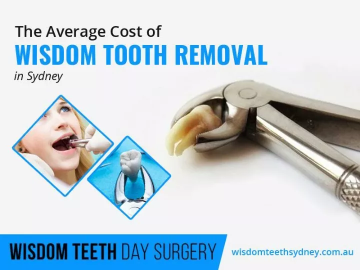 the average cost of wisdom tooth removal in sydney