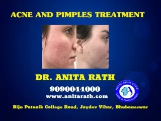 best acne and pimples treatment clinc in bhubaneswar odisha