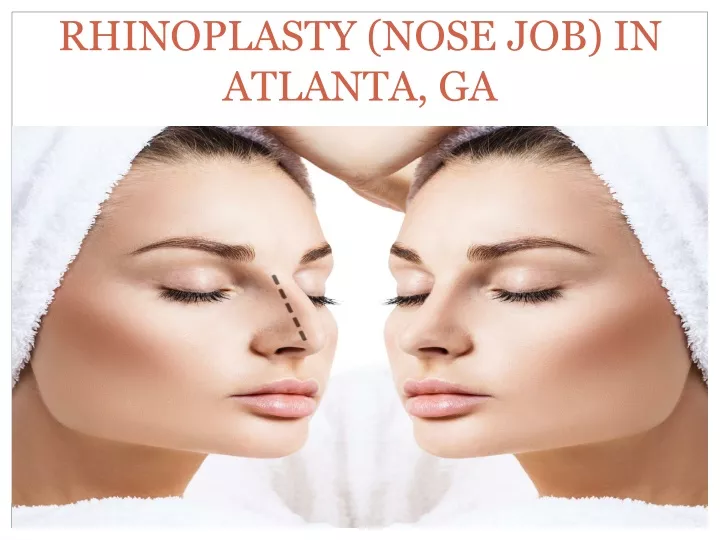 rhinoplasty nose job in atlanta ga