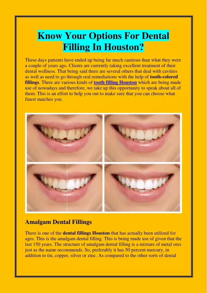 know your options for dental filling in houston