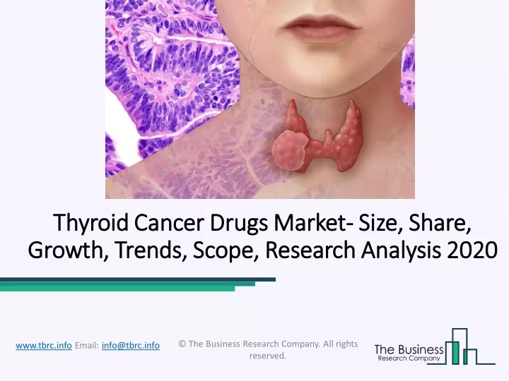 thyroid cancer thyroid cancer drugs market growth